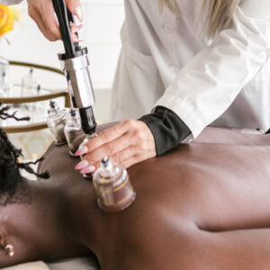 manual-cupping-education