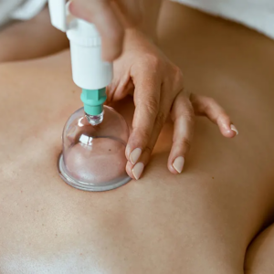 massage-cupping-therapy-education